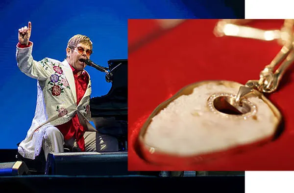 Elton John Has His Kneecaps Transformed Into 'Timeless' Gold Jewelry