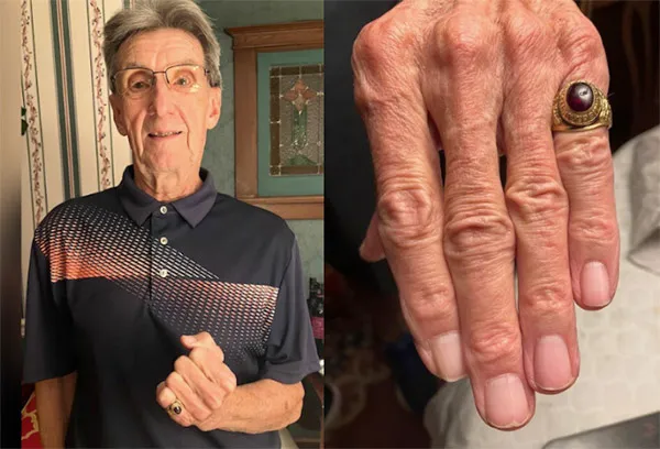 McMaster Grad Reunited With Class Ring Lost in Barbados Surf 47 Years Ago