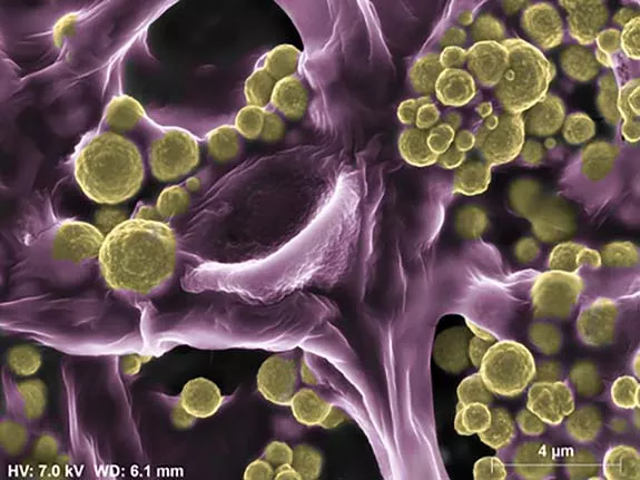 Read article: Gold-Loving Fungus Is the Latest in a Series of Low-Impact Exploration Tools